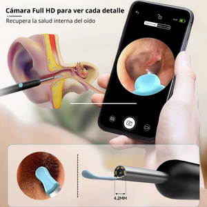 ClearScope™ – Limpieza profunda de oidos con visión HD