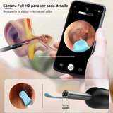 ClearScope™ – Limpieza profunda de oidos con visión HD